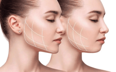The Science Behind Endolift: How It Works to Rejuvenate Your Skin