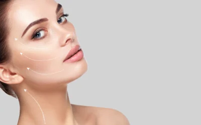 Endolift Facelift