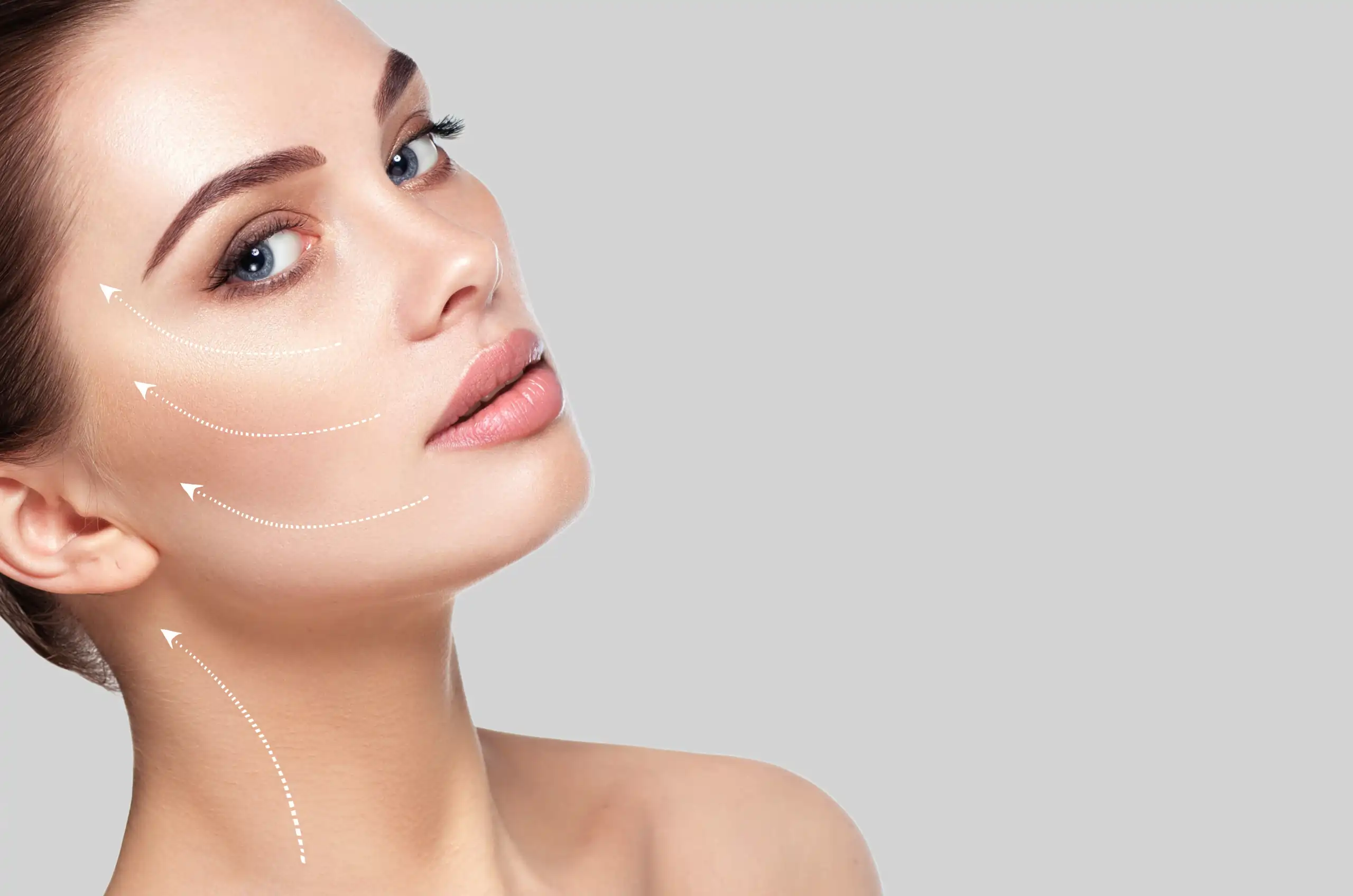 Endolift Facelift